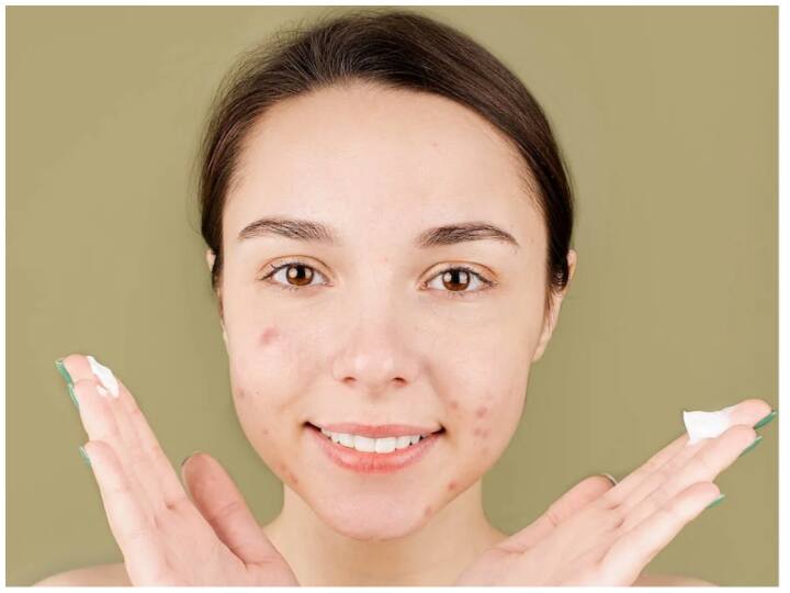 How To Get Rid Of Acne Scars Naturally Acne Scars Home Remedies