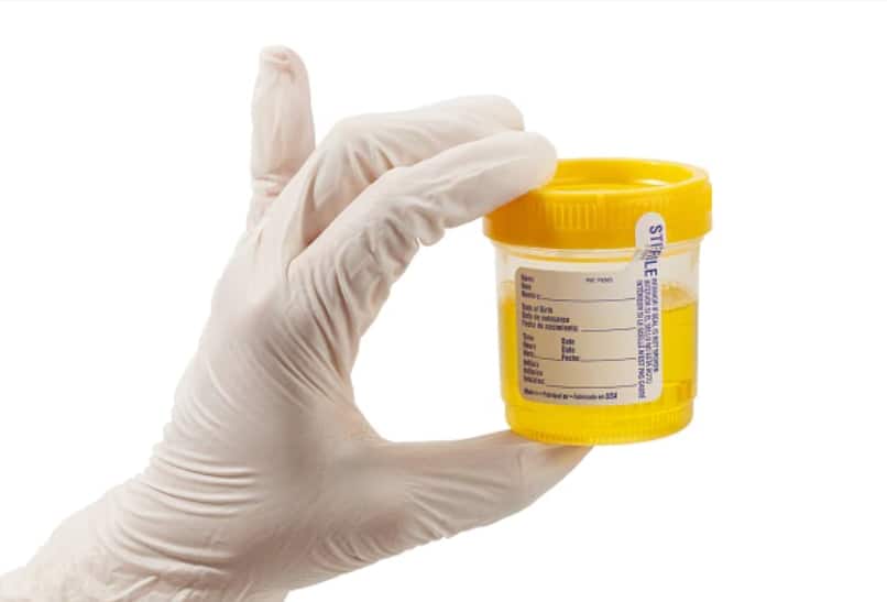 Urine Infection Can Be Very Harmful For Health