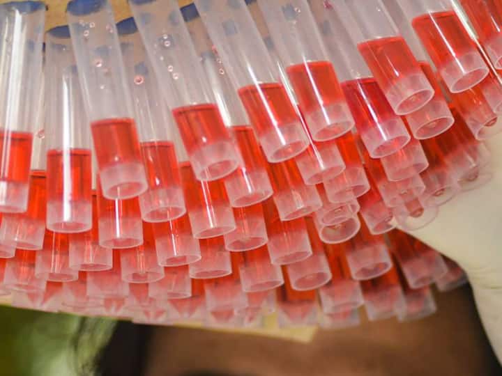 Coronavirus: 71 New Cases Of Surfaced In Mumbai On Wednesday