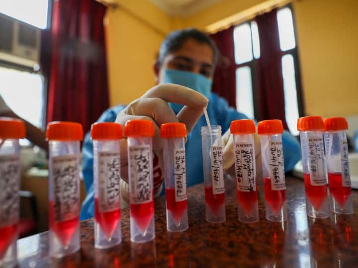 India Develops First Local Test To Detect Flu Covid In Single Swab