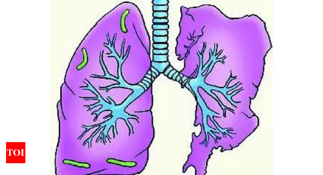 In India, prisoners 5 times more at risk of TB: Study