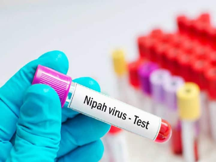 Nipah Virus Update Infection 20 Times Deadly Than Corona Covid While Mortality Rate Between 40 To 70