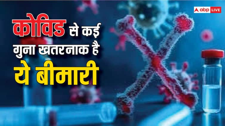 Health tips what is disease x 20 times severe than covid-19 know about this health condition Disease X: क्या है डिजीज X जिसे डॉक्टर बता रहे हैं कोरोना महामारी से 20 गुना ज्यादा पॉवरफुल, इस तरह करें बचाव