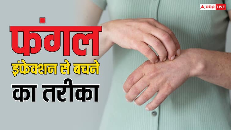 Tips to ward off fungal infections during monsoon read full article in hindi Monsoon Tips: बरसात के दौरान क्यों बढ़ जाते हैं फंगल इंफेक्शन के मामले? जानें इसे रोकने का तरीका