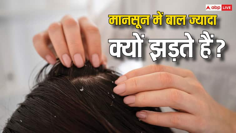 Why Hair Fall and Dandruff Increase During Monsoon? Find Out the Reasons मानसून में क्यों होती है बाल झड़ने और डैंड्रफ की समस्या? जान लीजिए जवाब